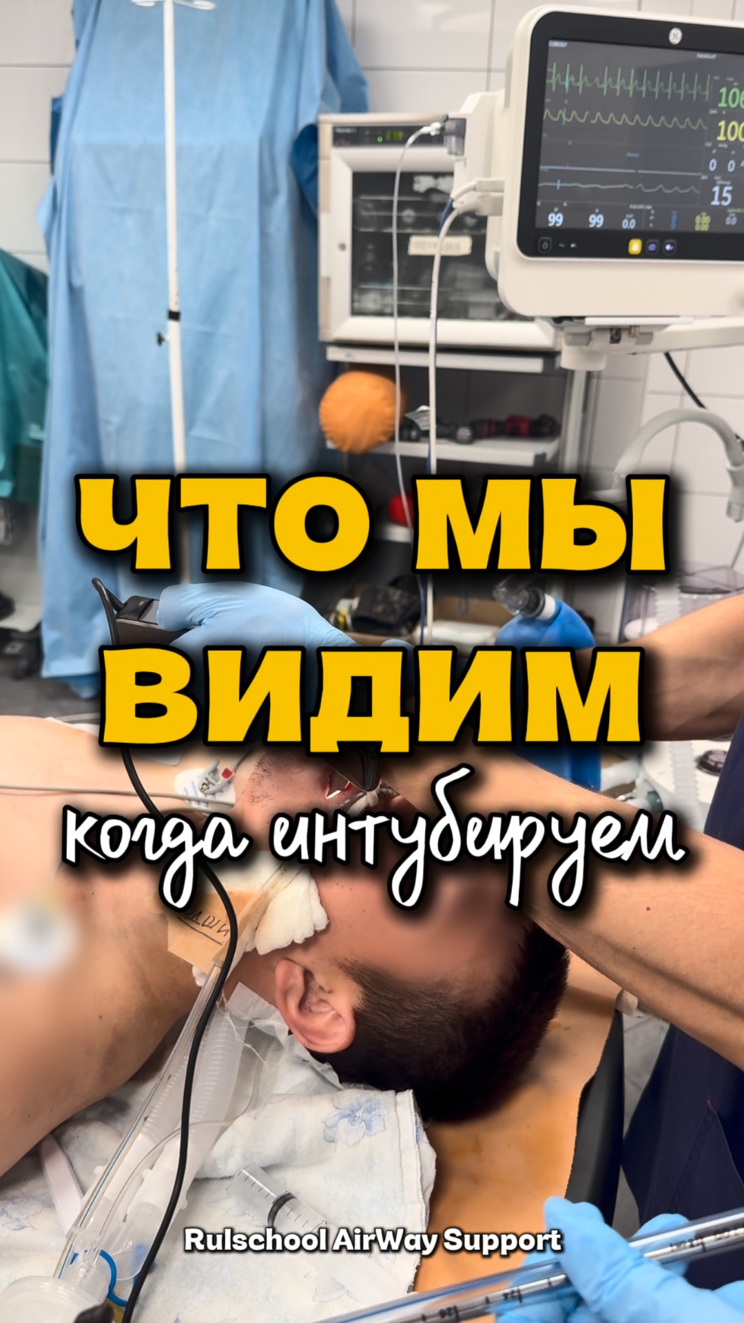 Эндоскопическая анатомия верхних дыхательных путей при видеоларингоскопии
