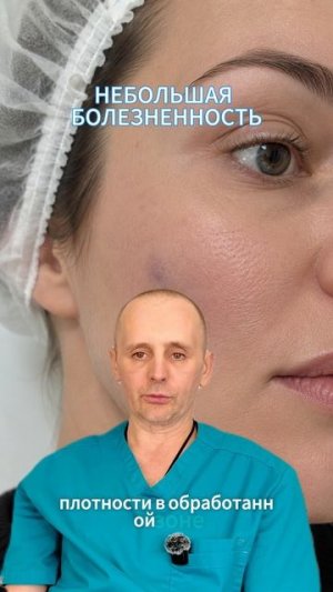Отёк и синяки после полимолочной кислоты