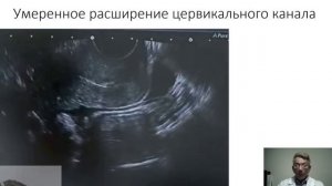 Анализ коротких видео по теме Малый таз