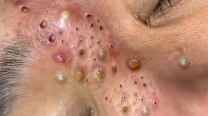 Советы по очищению и уходу за кожей лица