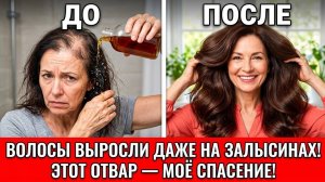 Выбросьте дорогие маски! Всего 1 ингредиент — и волосы растут даже на залысинах! Стали в 3 раза гуще
