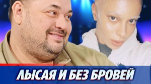 Дочь Сергея Жукова стала лысой и без бровей ★ Новости Шоу-Бизнеса