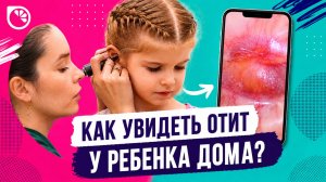 ОТИТ МОЖНО УВИДЕТЬ ДОМА! Как проверить ухо ребенка на камеру?