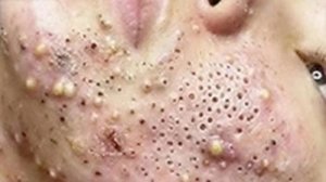 Успокаивающий уход за лицом для снятия стресса