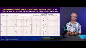Обзор алгоритмов анализ сложных ЭКГ