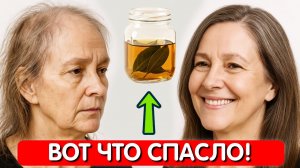 БЫЛА ПОЧТИ ЛЫСАЯ... А теперь ВОЛОСЫ РАСТУТ как сумасшедшие и стали гуще. Спасибо, ЛАВРОВЫЙ ЛИСТ🌿
