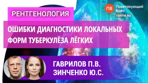 Гаврилов П.В., Зинченко Ю.С.: Ошибки диагностики локальных форм туберкулёза лёгких.