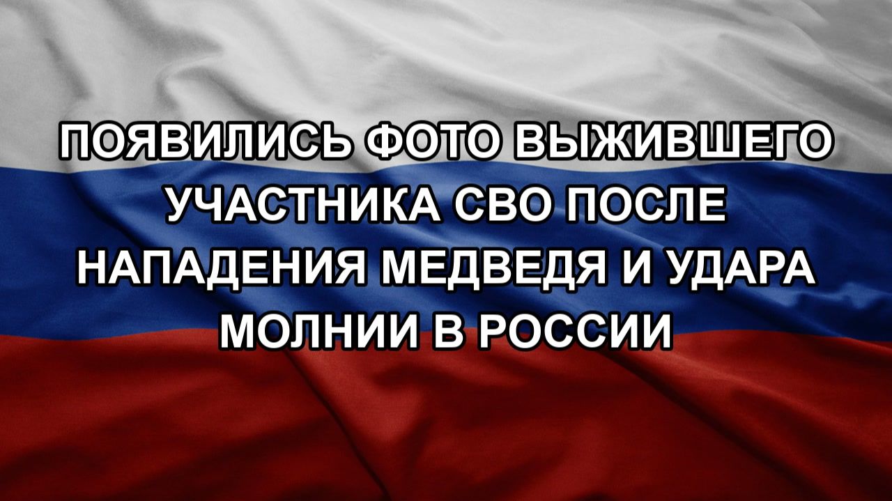 Появились фото выжившего участника СВО после нападения медведя и удара молнии в России