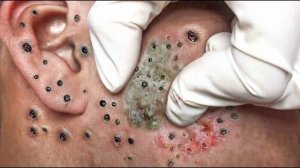 Успокаивающий уход за лицом для снятия стресса