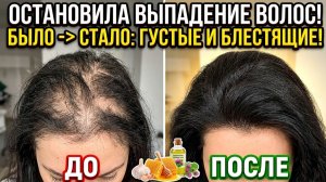 ЛЫСИНА ЗАРОСЛА ЗА МЕСЯЦ ! Моя секретная маска - Волосы растут как сумасшедшие и стали гуще в 3 раза