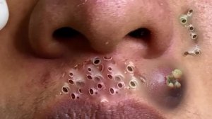 Обретите внутренний покой с этими методами очищения лица.