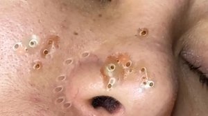 Экстремальное удаление чёрных точек: удовлетворение и релакс