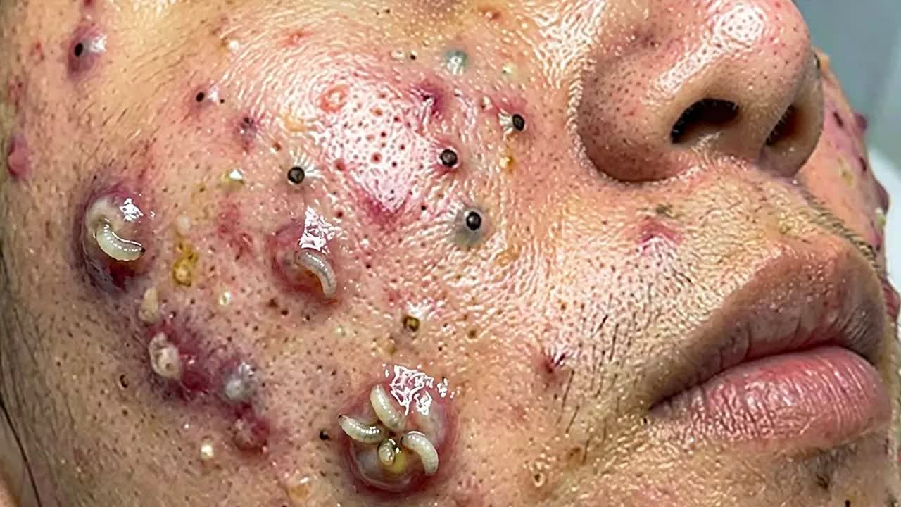 Успокаивающий уход за лицом для снятия стресса в люксовом спа — обретите внутреннюю гармонию