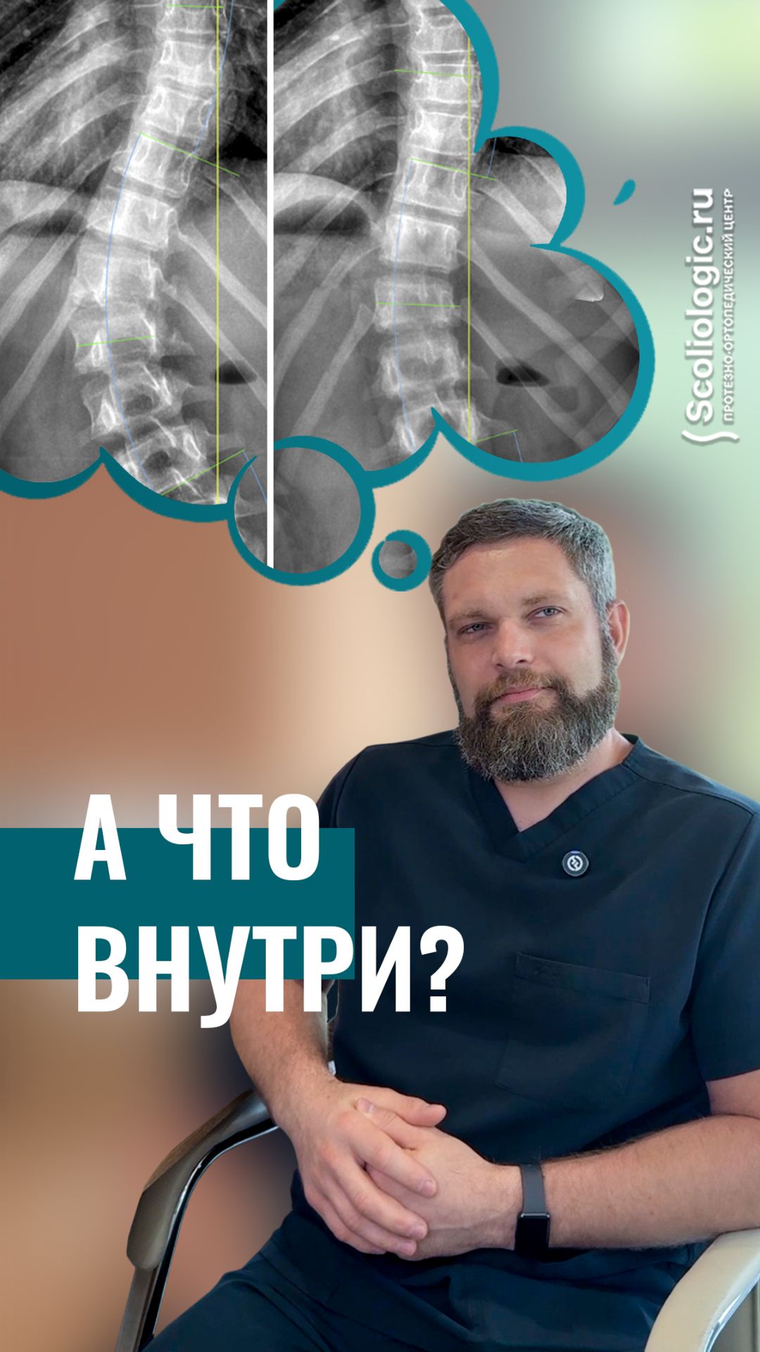 Как сколиоз влияет на внутренние органы и можно ли это исправить?