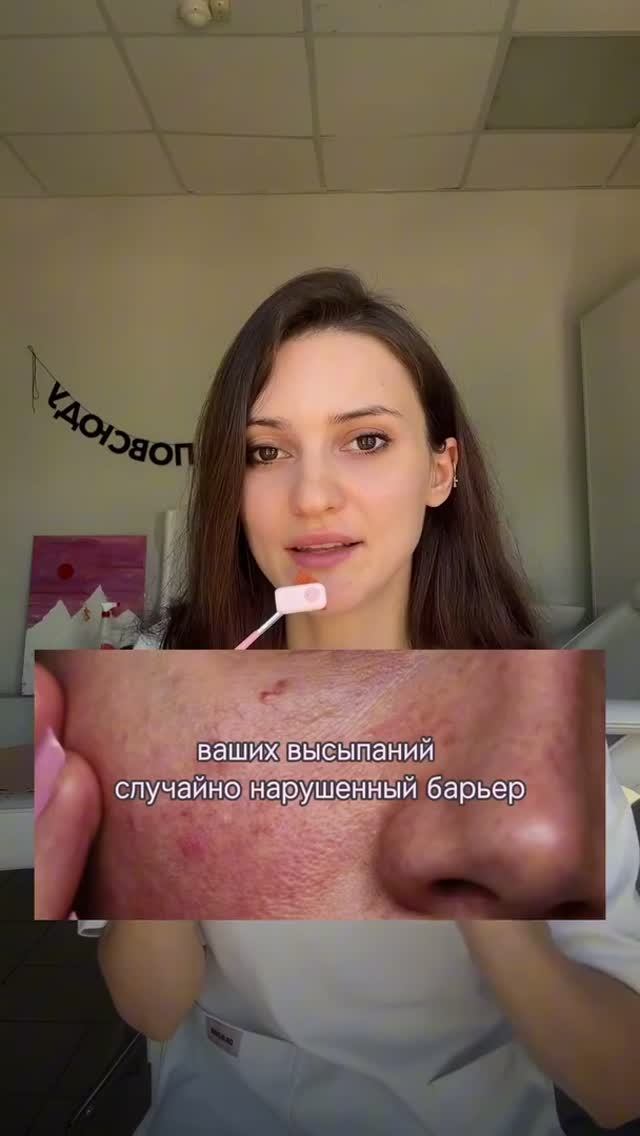Разбираю вопросы из Threads про Эффезел, рубцы постакне, высыпания на теле.