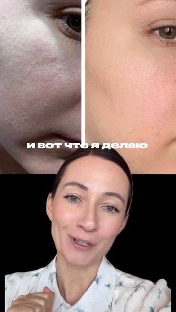 Как избавиться от пор? Ответ в описании #ольгапетрунина #skincare #кожалица #уходзакожей