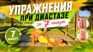 Упражнения при диастазе за 7 минут