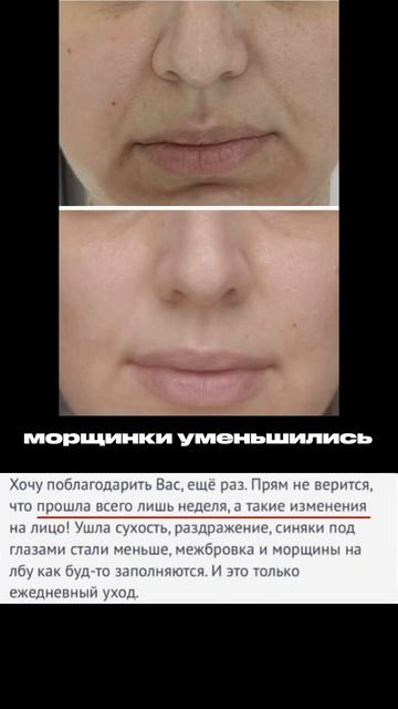 Подбор домашнего ухода онлайн #ольгапетрунина #skincare #кожалица #уходзакожей