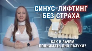 Все про синус-лифтинг: что это, зачем он нужен перед имплантацией зубов. закрытый, открытый метод.