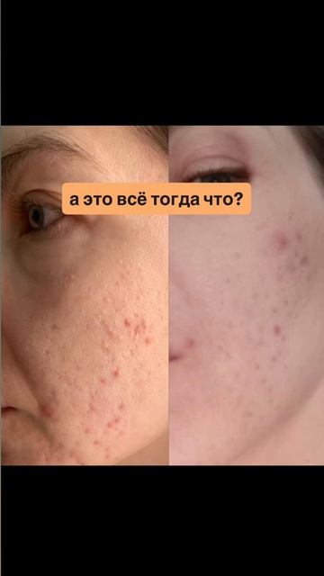 Что на самом деле помогает вашей коже