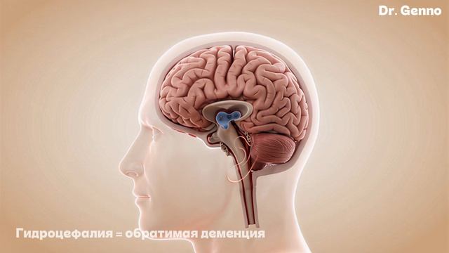🧠 Болезнь Альцгеймера: 10 ранних признаков, которые нельзя игнорировать