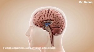 🧠 Болезнь Альцгеймера: 10 ранних признаков, которые нельзя игнорировать