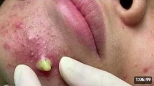 КОРЕЙСКИЙ УХОД. ЧИСТКА КРУПНЫМ ПЛАНОМ. ЭТО ШОК!