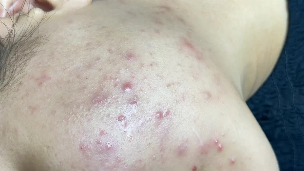 Расслабляющая чистка лица с LinhMyDang Spa