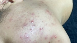 Расслабляющая чистка лица с LinhMyDang Spa