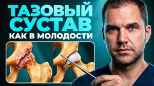 КОКСАРТРОЗ тазобедренного сустава — возможно ли вылечить БЕЗ операции?