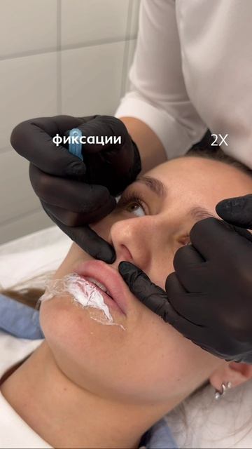 Губы спустя год после увеличения — что с ними происходит и нужна ли повторная коррекция? 👄