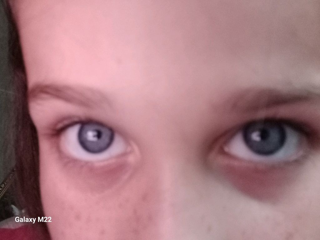 и