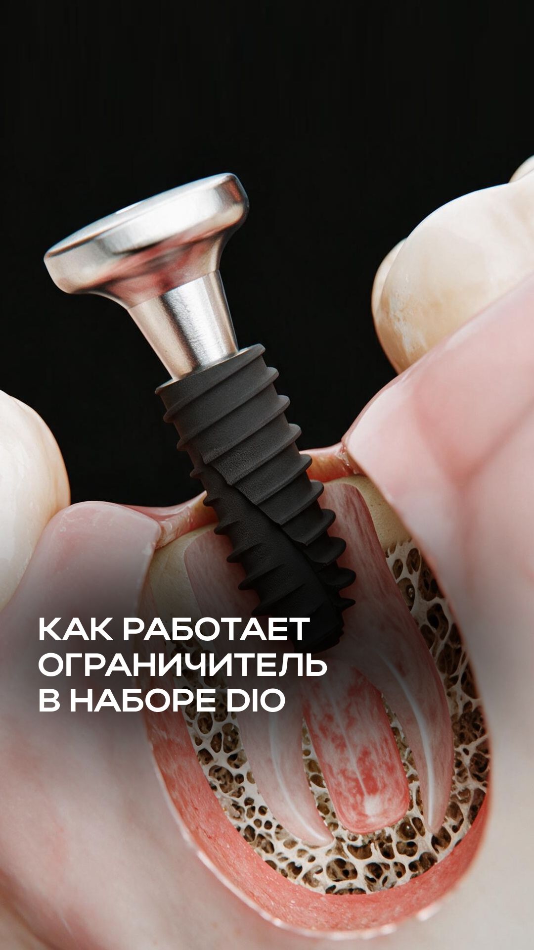 Читайте описание 👇🏻