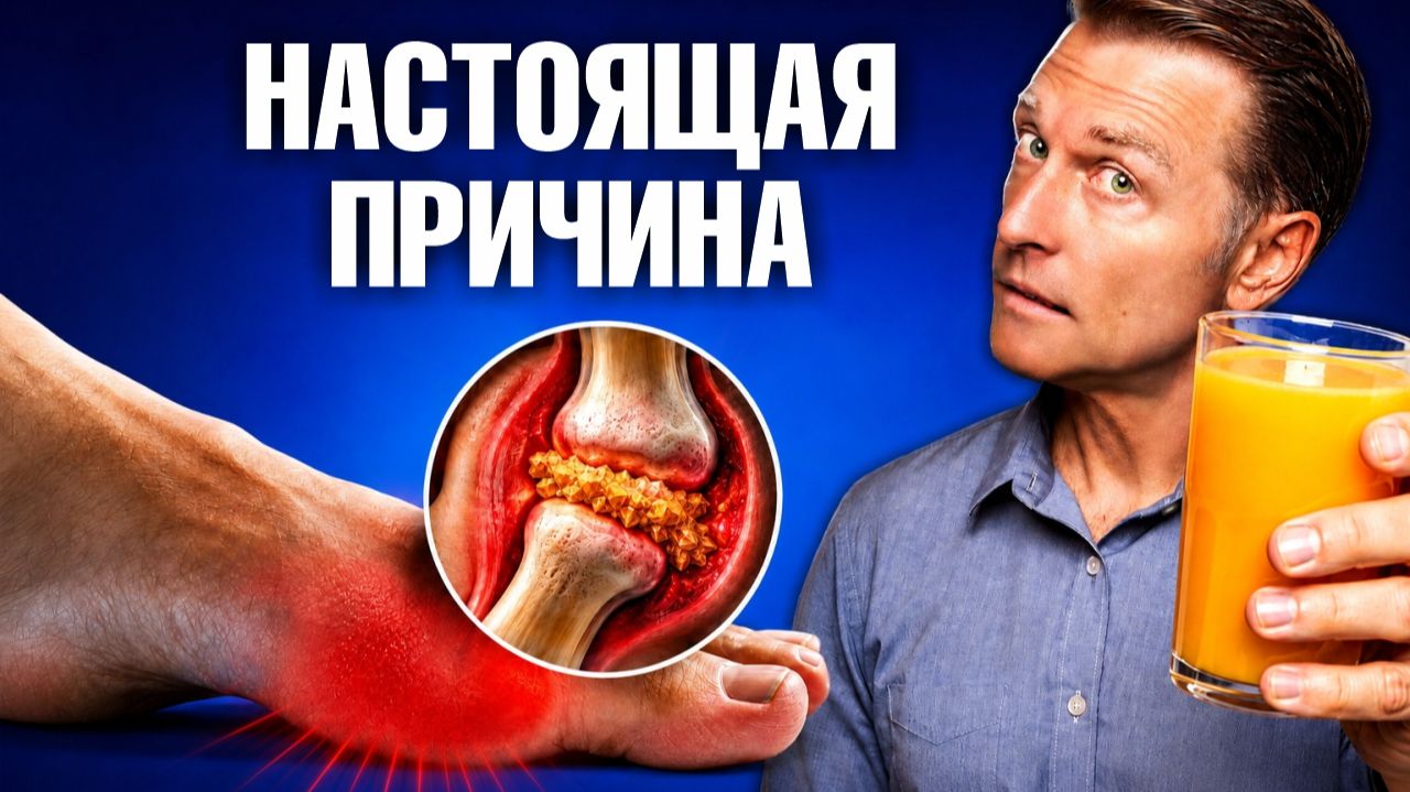 Подагра уйдет навсегда: делайте ЭТО каждый день