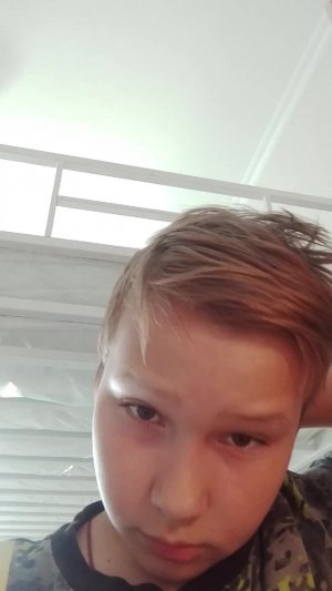 попор