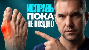 ВАЛЬГУС: если у вас «КОСТОЧКА» на большом пальце ноги — посмотрите ЭТО видео