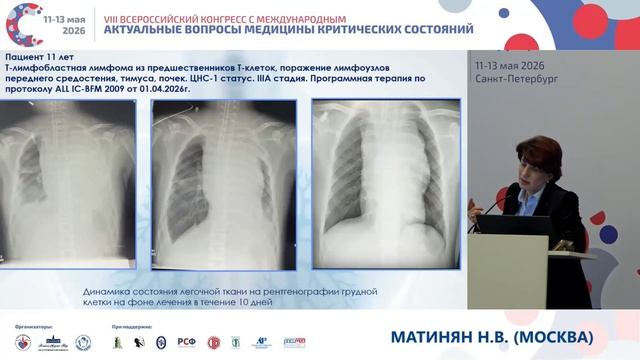 Стратегия ведения пац с опухол переднего средостения Матинян Н.В.