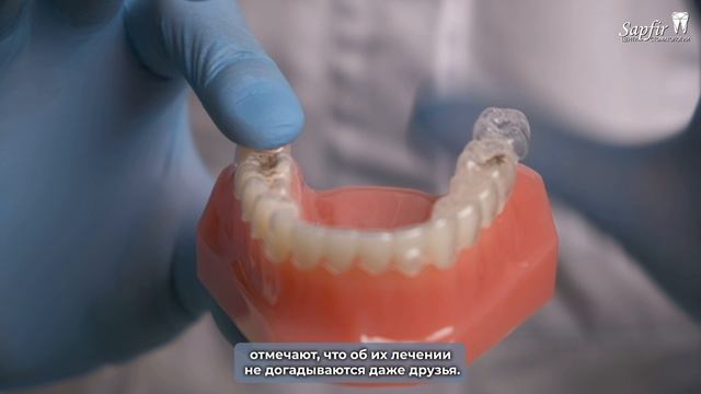 Элайнеры Зорина Е.А. 3