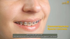 Брекеты Шалоумова Ю.С. 3