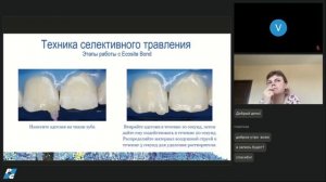 Ecosite: Адгезивный код. Как разгадать главный секрет идеальной реставрации