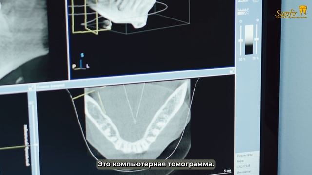 Брекеты Шалоумова Ю.С.