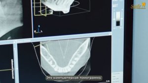Брекеты Шалоумова Ю.С.