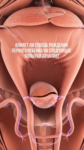 Влияет ли способ первых родов на последующую фертильность?