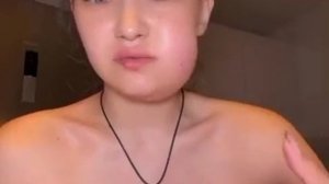 😳 Девушка показала, что будет, если удалить два зуба мудрости за раз
