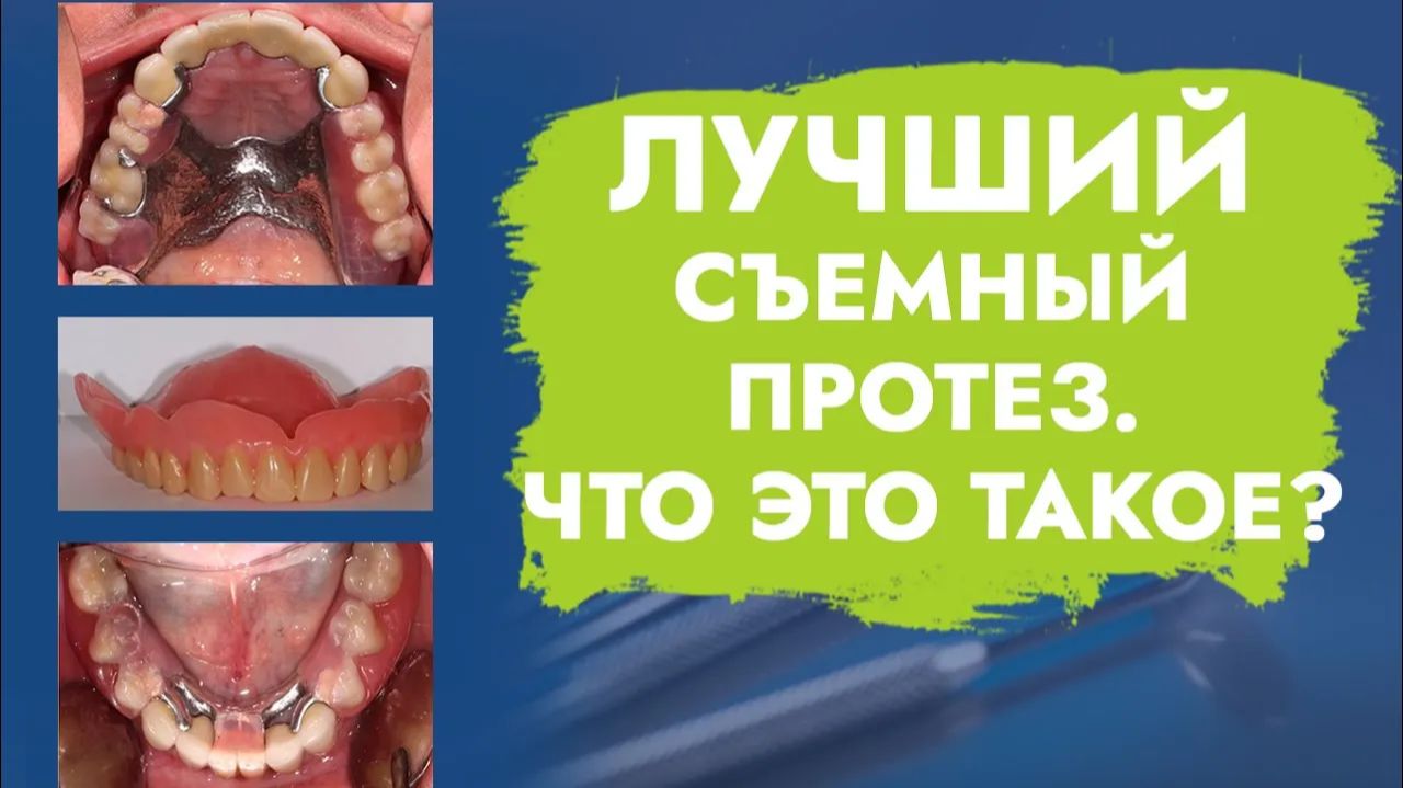 Как сделать съемный протез эстетичным и функциональным?