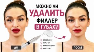 Можно ли филлер в губах удалили до или после