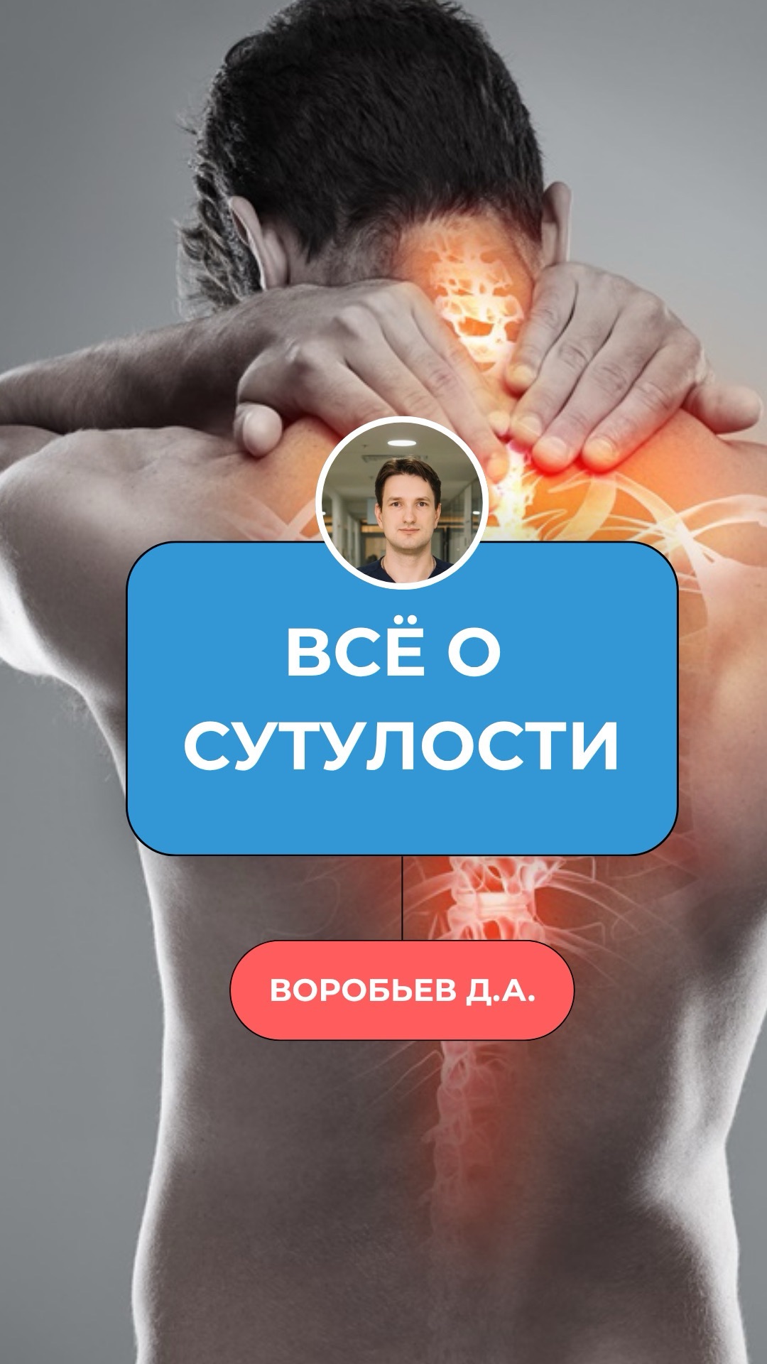 Сутулость — часто не из-за слабой спины. А из-за одной мышцы спереди 👇