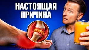 Как избавиться от подагры: делайте ЭТО каждый день🙌