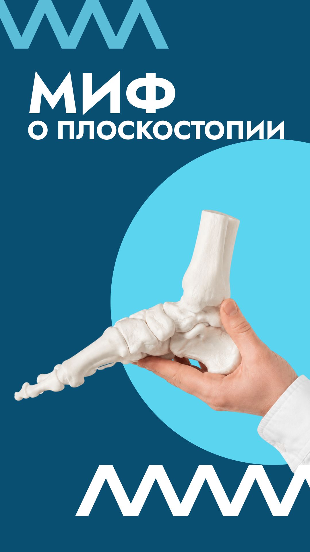 Плоскостопие - не приговор