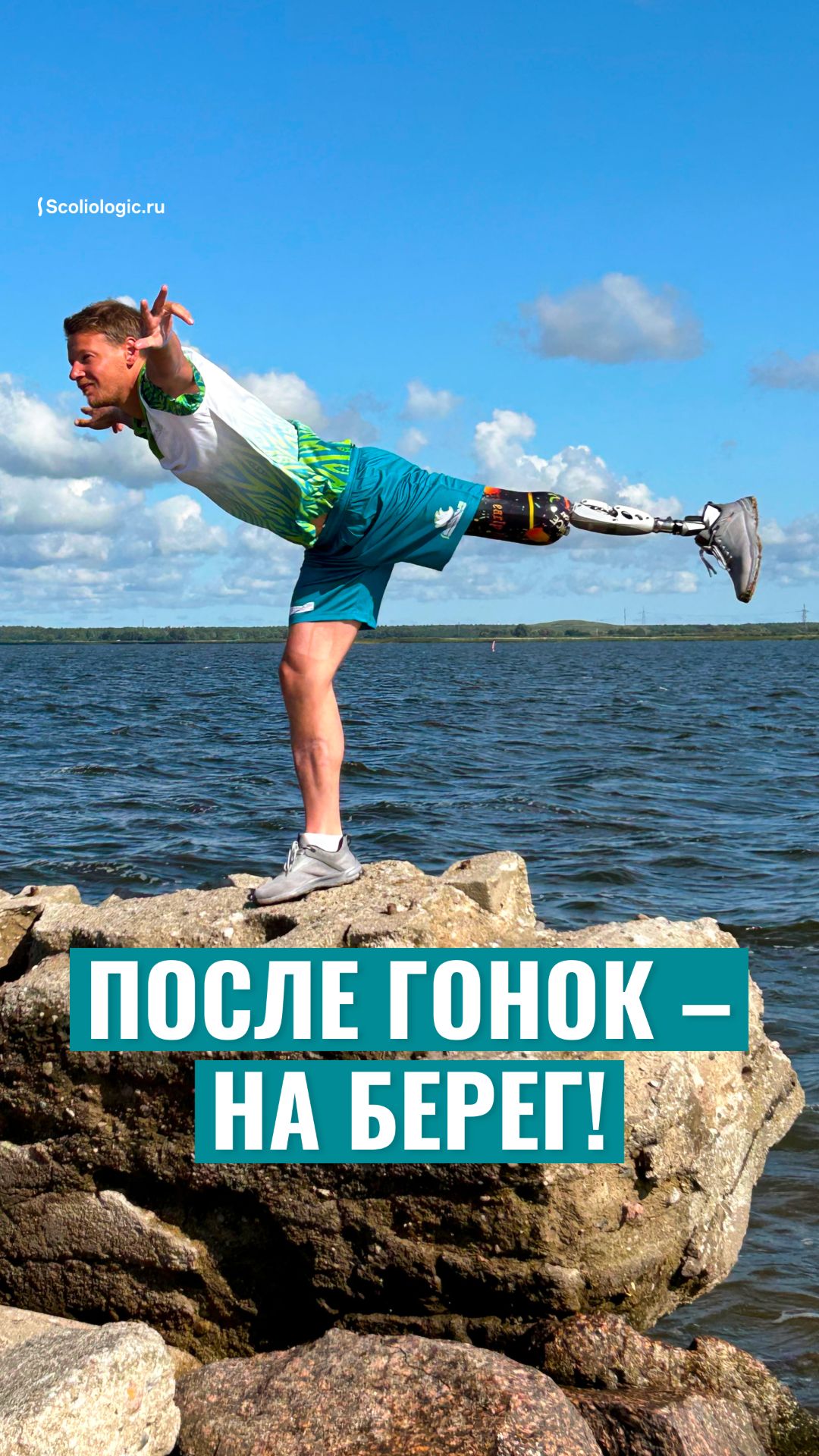 На протезах ног в Калининграде